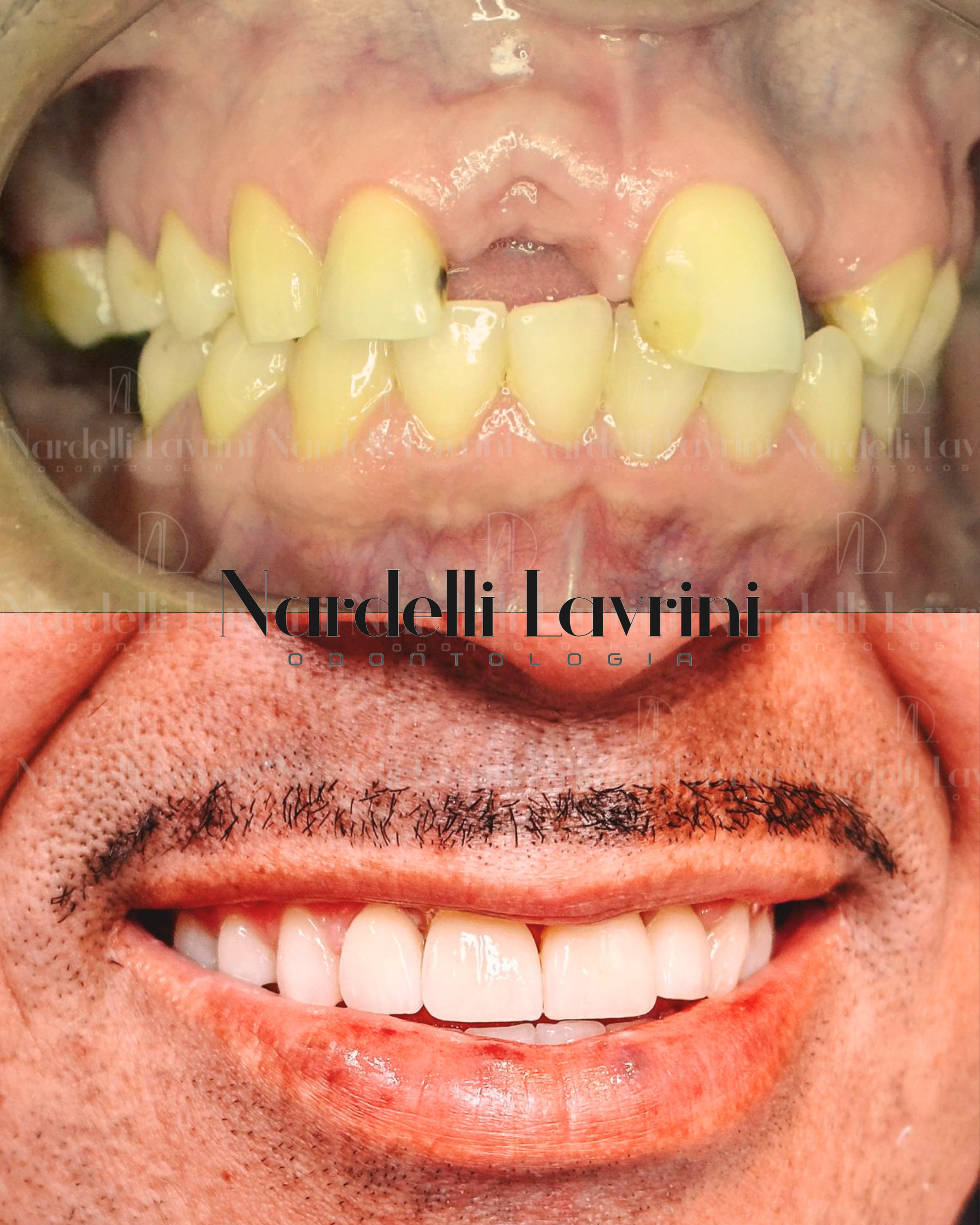 Antes e Depois (1)
