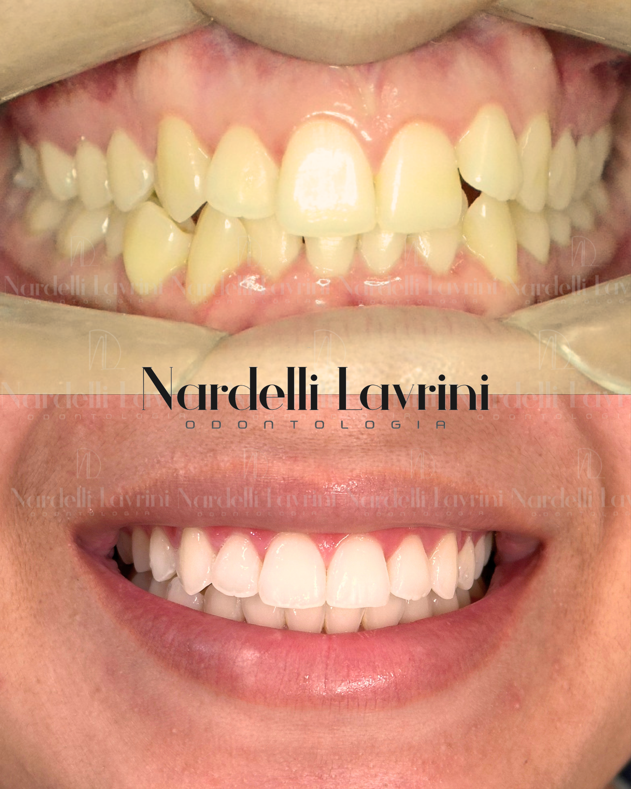 Antes e Depois (3)
