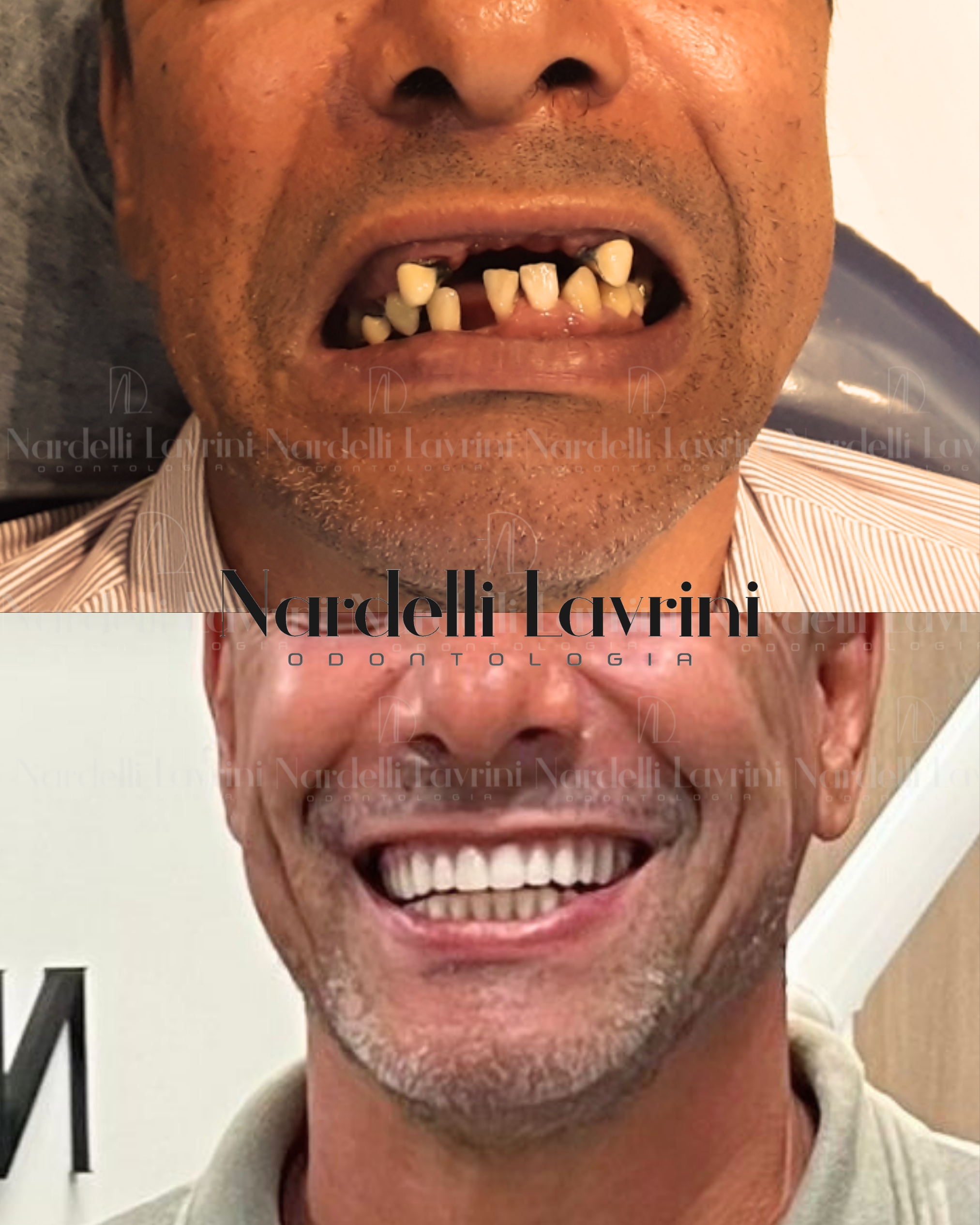 Antes e Depois (4)